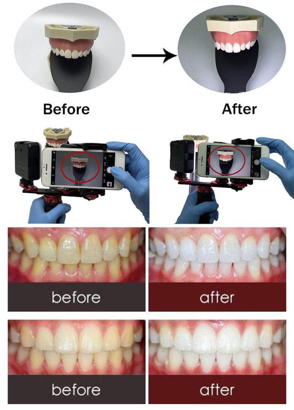 کیت نورپردازی سالی Salli Dental Photography light - Image 2